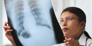 radon-and-health-300×200